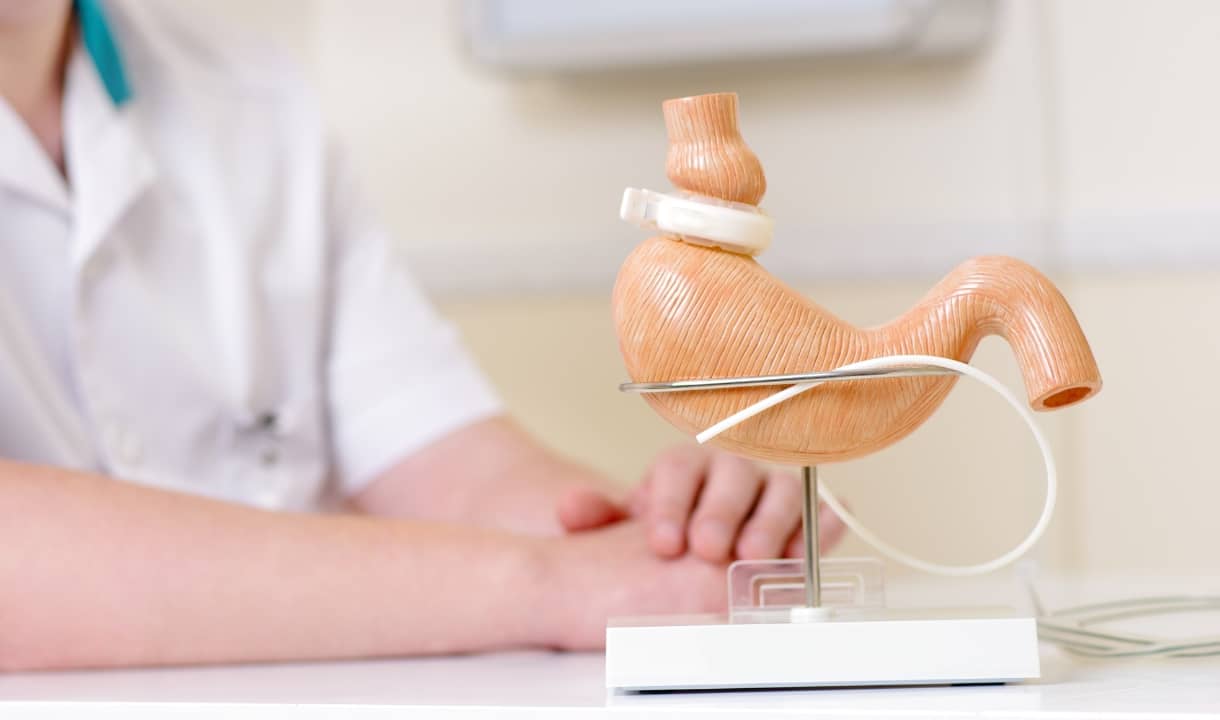 Cirurgia Bariátrica