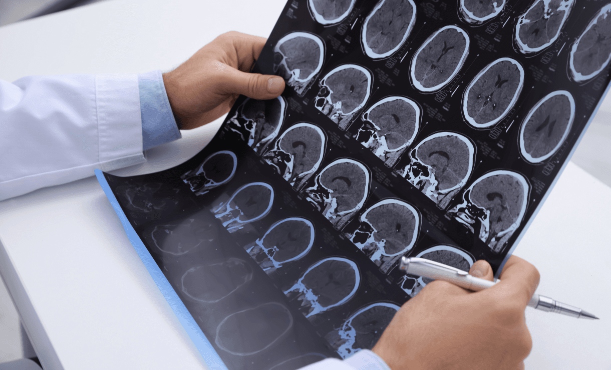 Neurologista pelo Bradesco Saúde